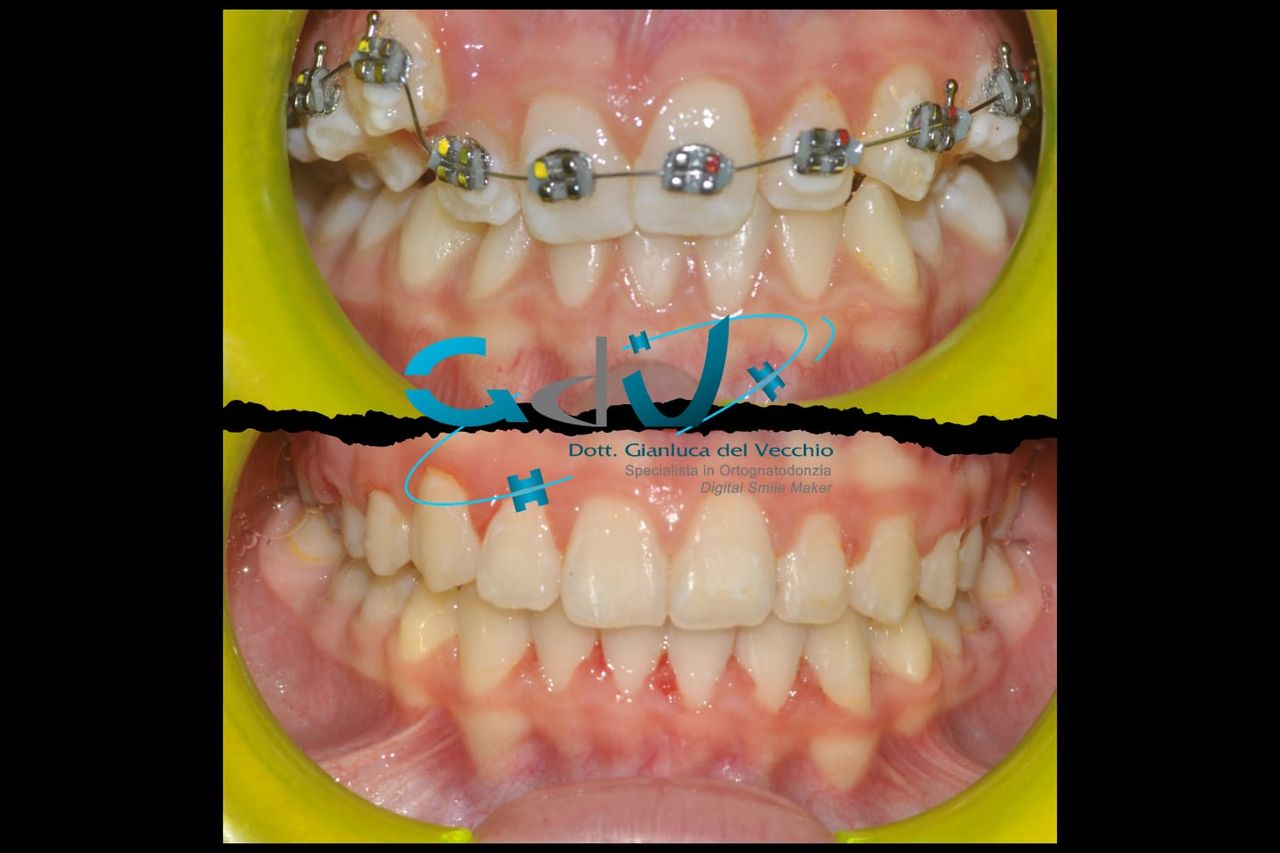 Gianluca Del Vecchio-150