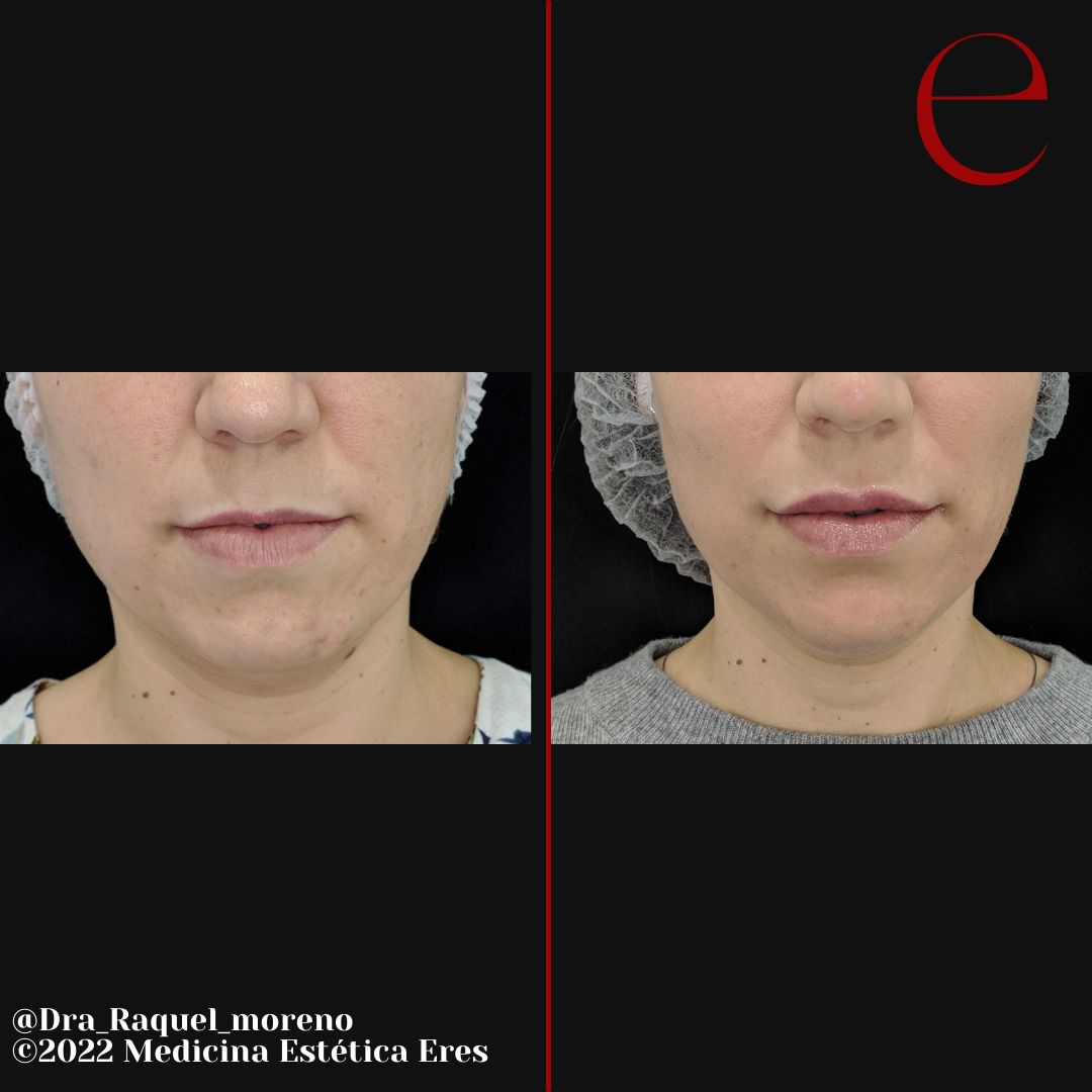 Raquel Moreno Pentinel-84