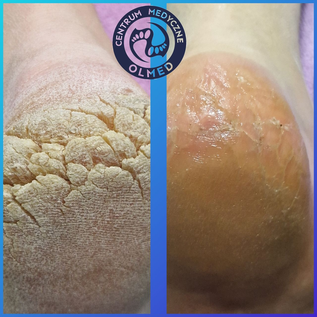 Aleksandra  Górecka -1