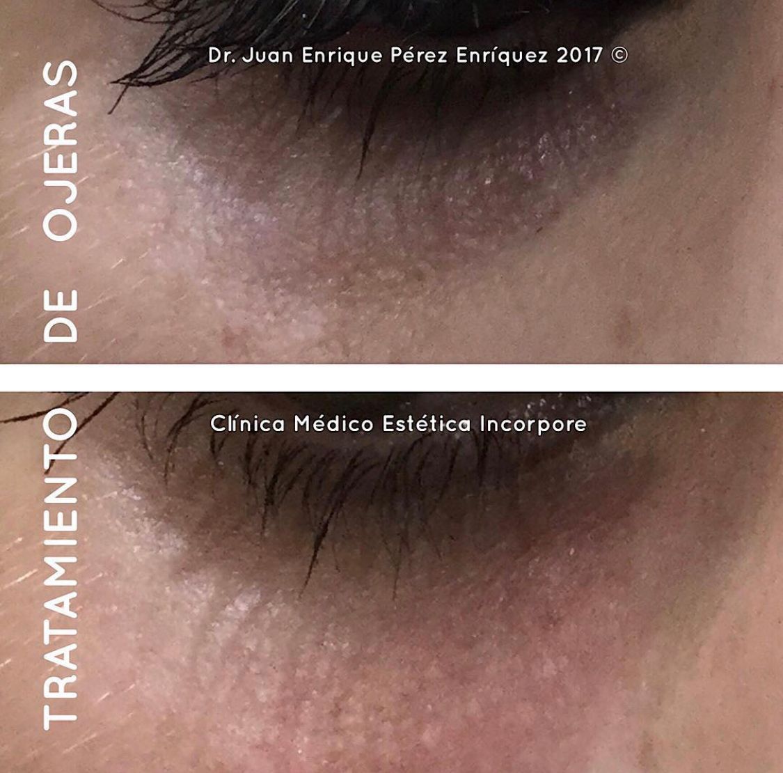 Juan Enrique Pérez Enríquez-67