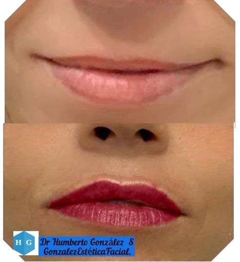 Humberto González Sánchez-17