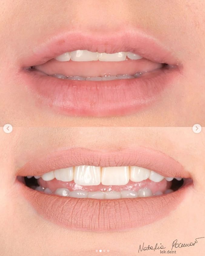 Natalia Pochroń-Sawka-2