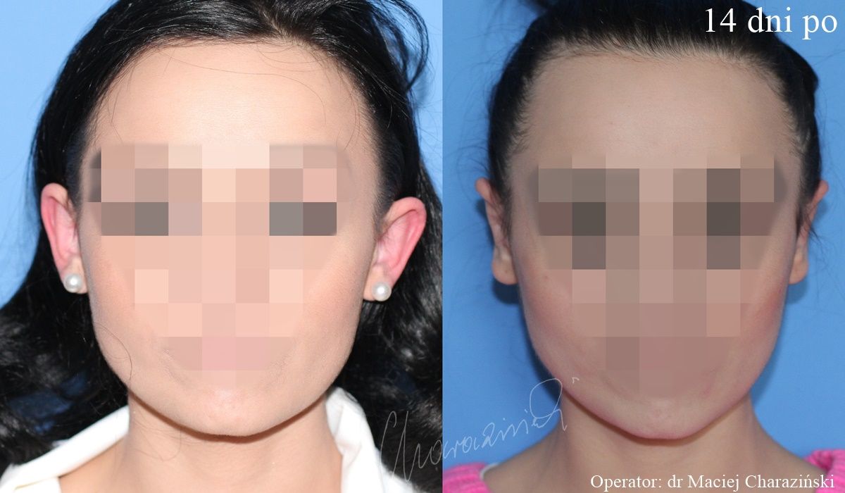 Maciej Charaziński-135