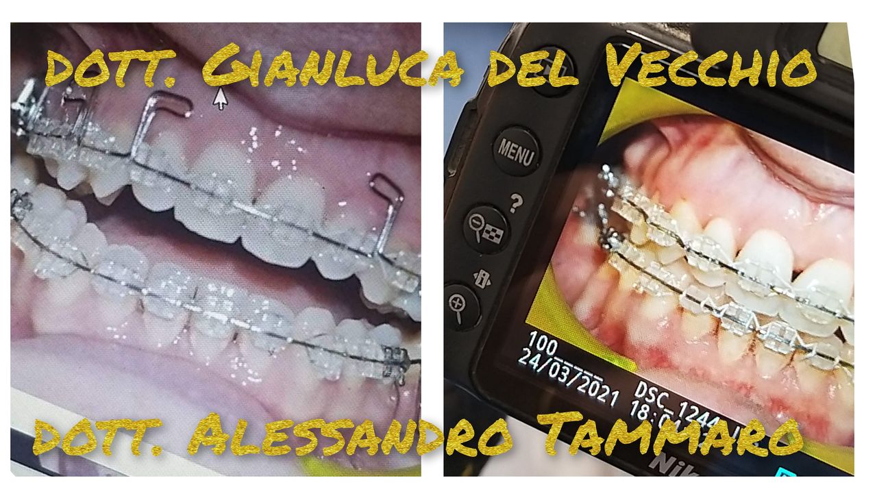 Gianluca Del Vecchio-83