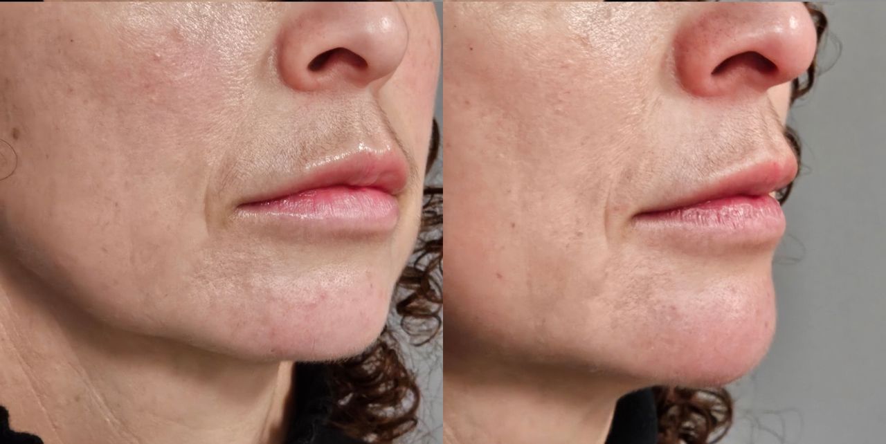 Rosalba Herrero Zerpa-446