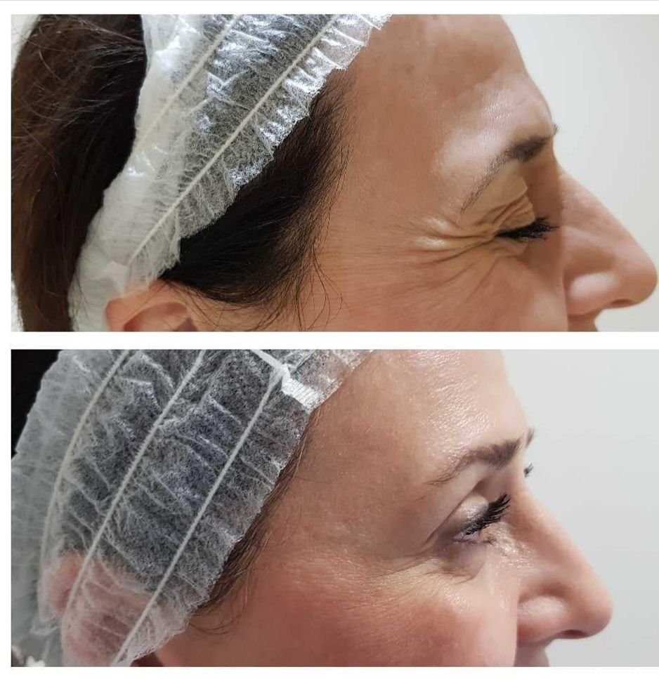 Rosalba Herrero Zerpa-556