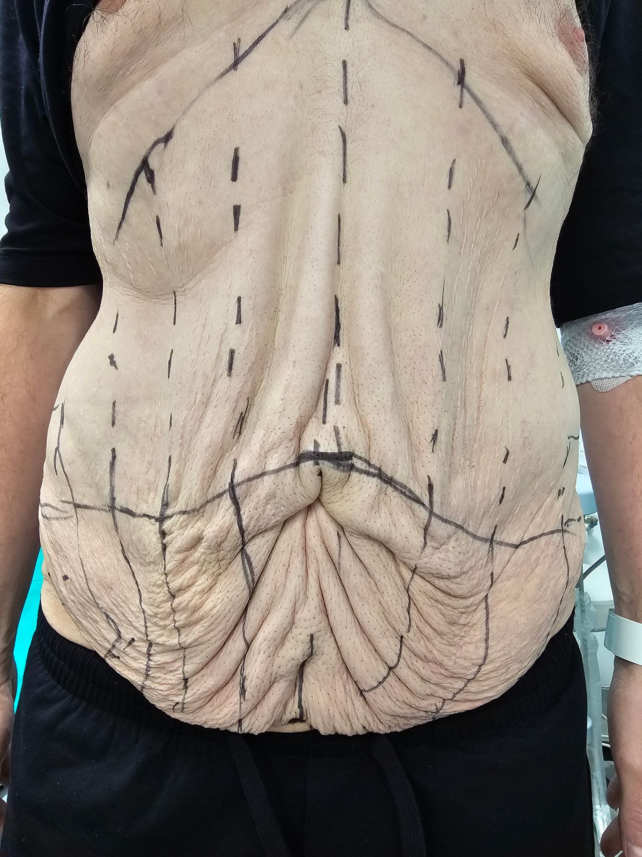 Bartłomiej  Staśkiewicz -9