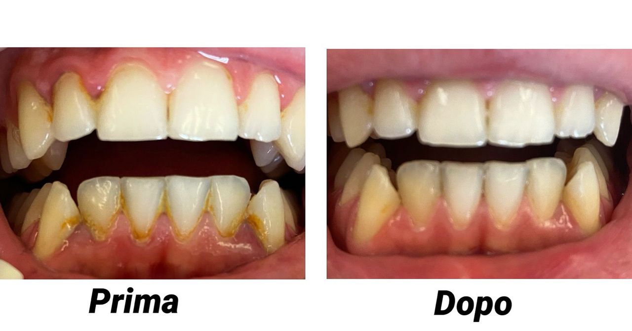 Federica Del Villano-3
