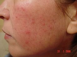 Enzo Angelo Giudice-10