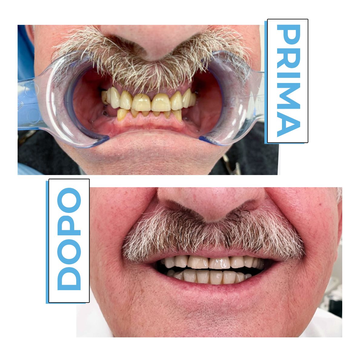 Francesco Anaclerico-21