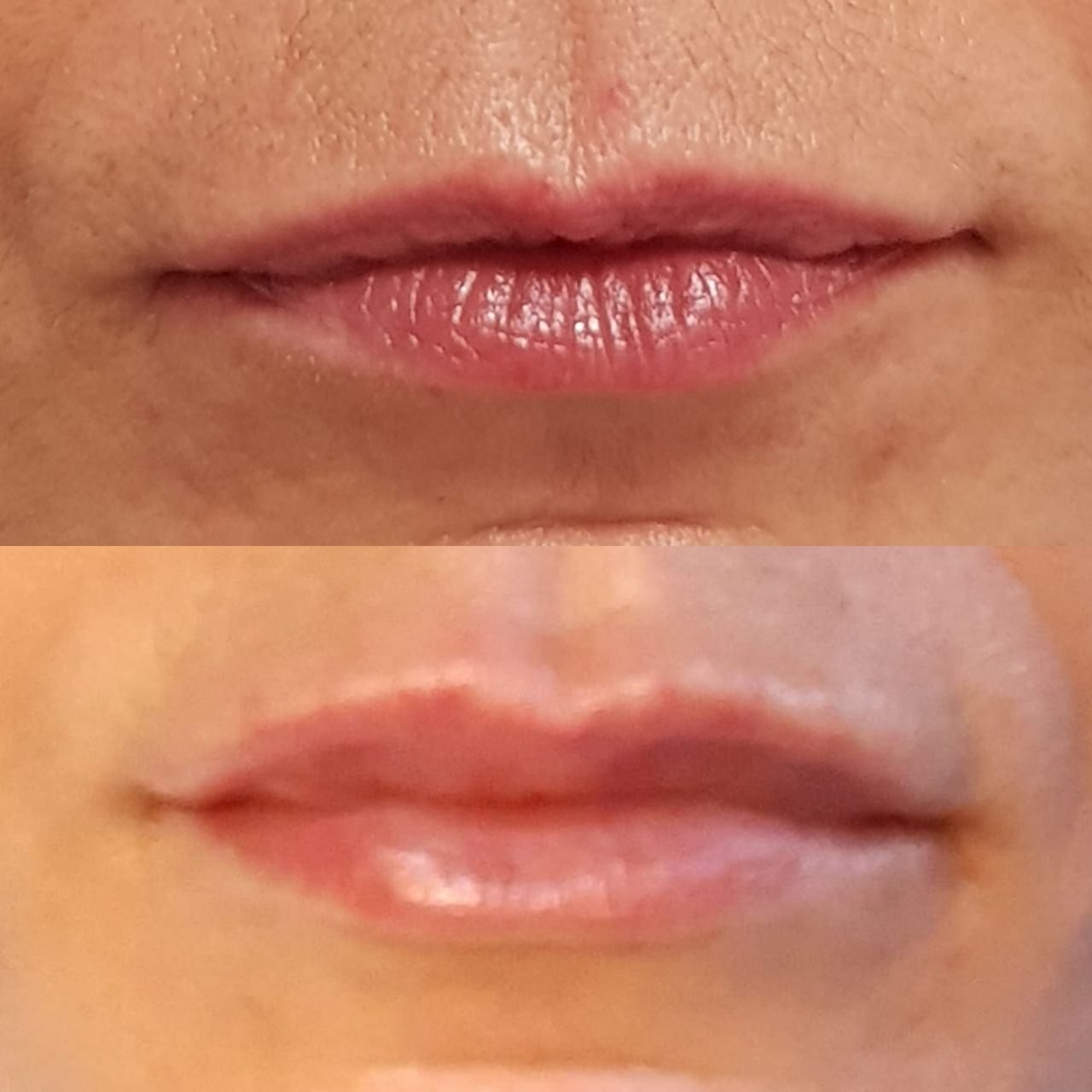 Rosalba Herrero Zerpa-279