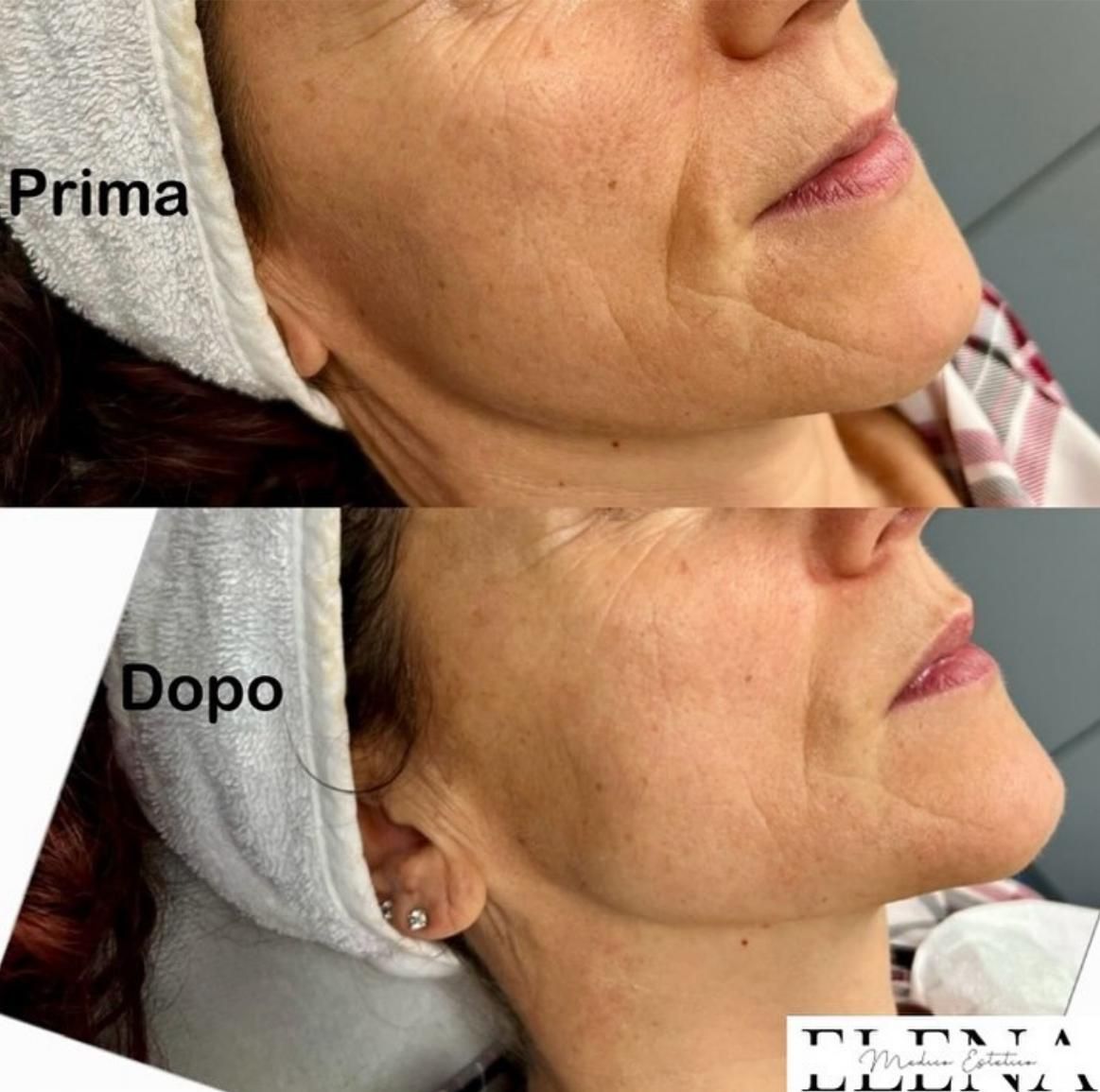 Elena Della Vecchia-0