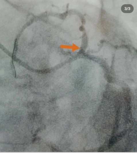 Hüseyin Onur Şahin-16