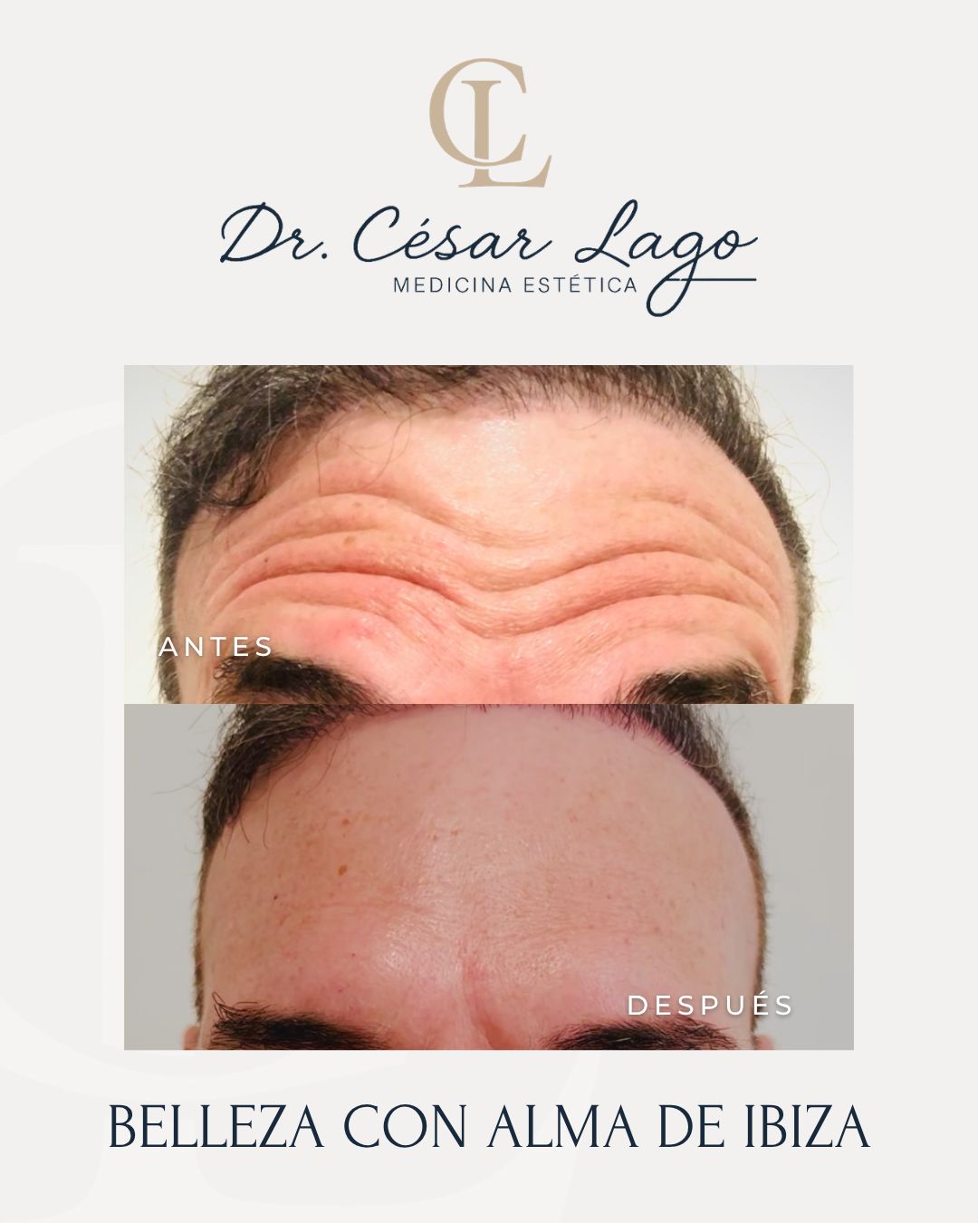 César Lago-8