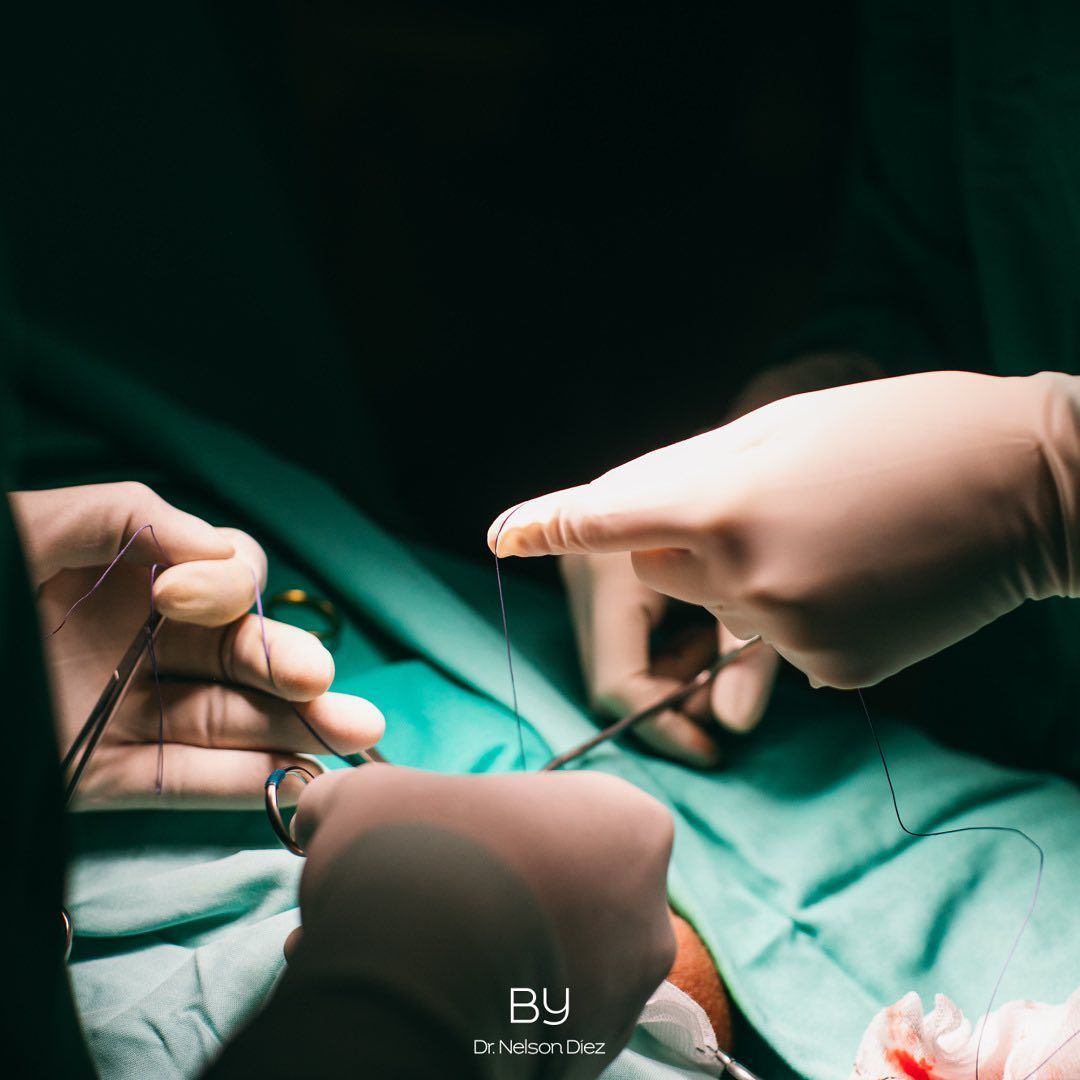 Nelson Diez Calzadilla-8