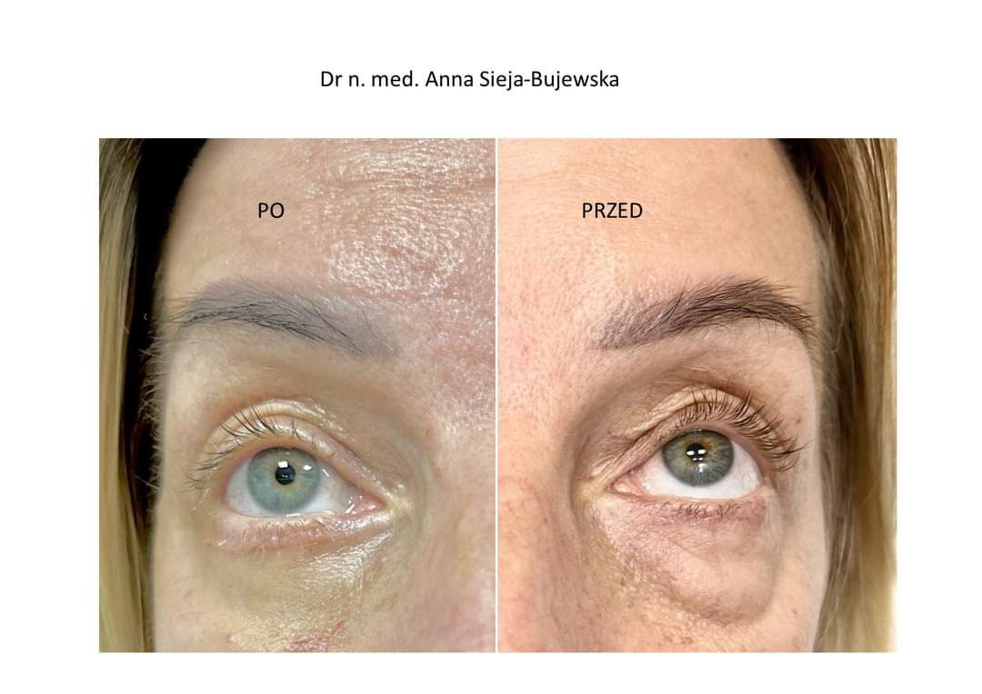 Anna Sieja-Bujewska-17