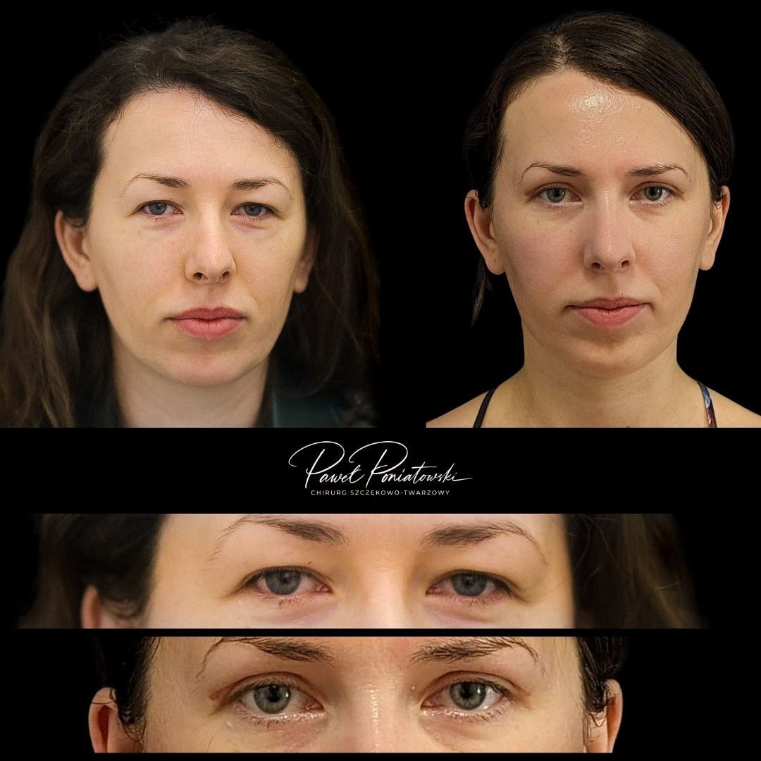 Paweł Poniatowski-12