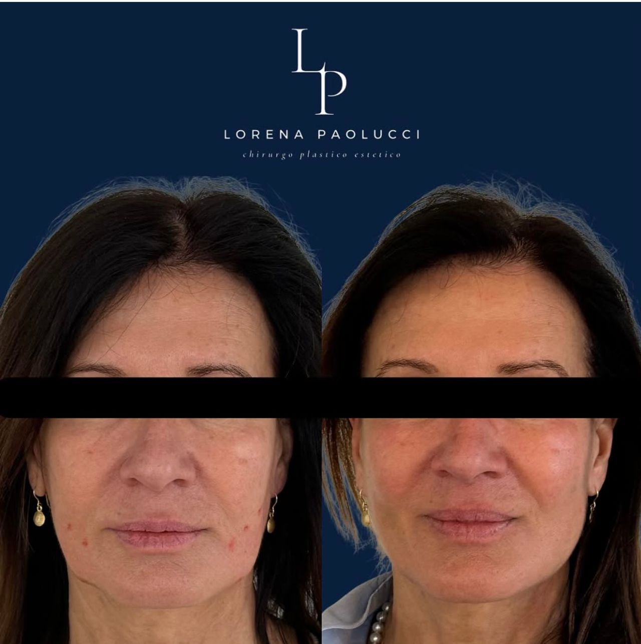 Lorena Paolucci-48