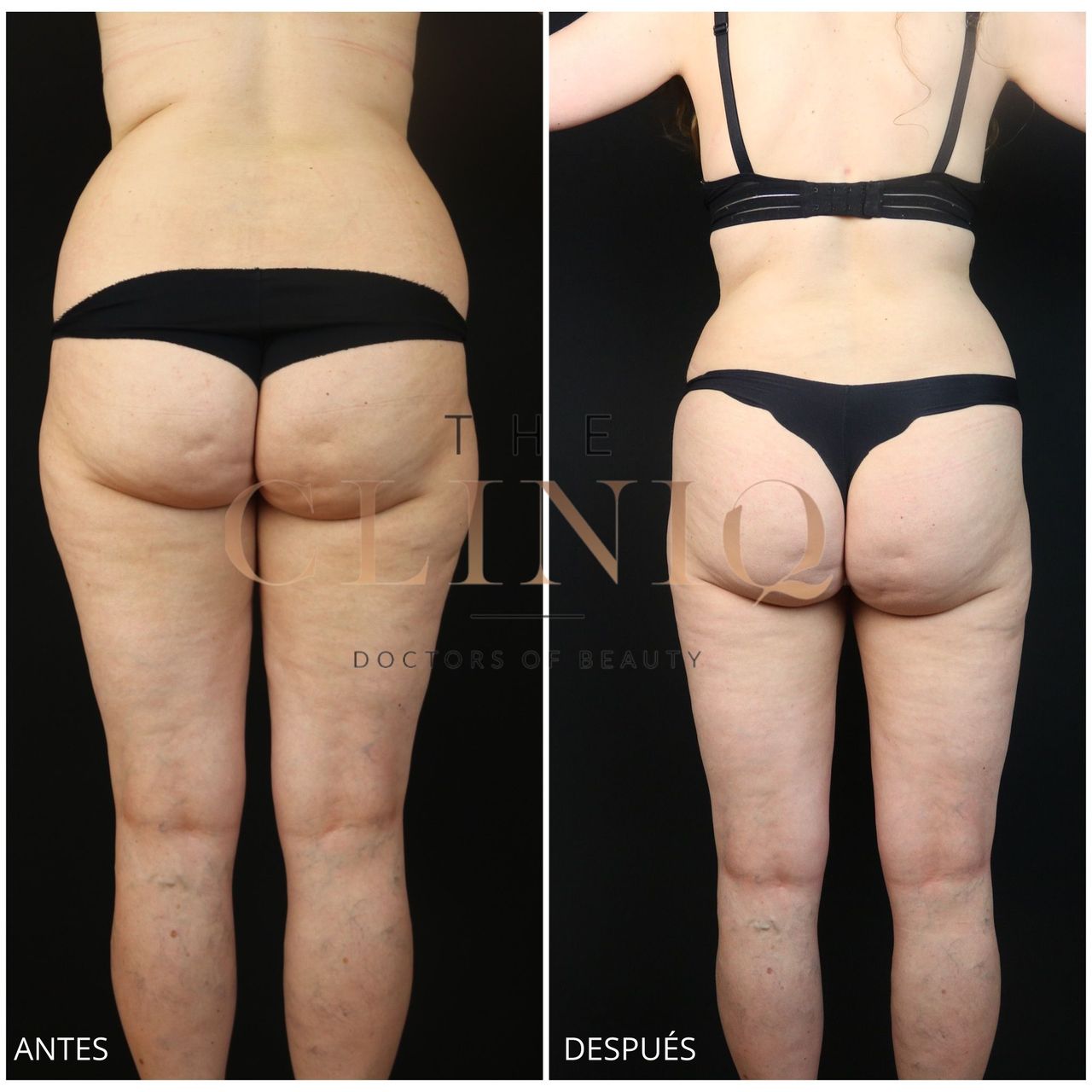 Ricardo Coronel Gagliardi-5