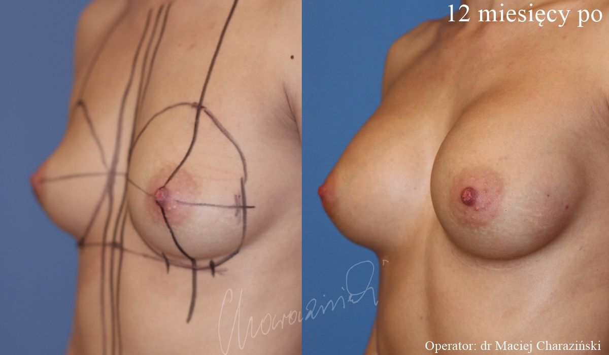 Maciej Charaziński-102