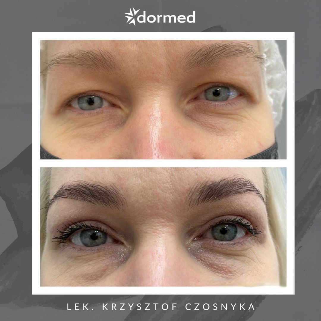 Krzysztof Czosnyka-3