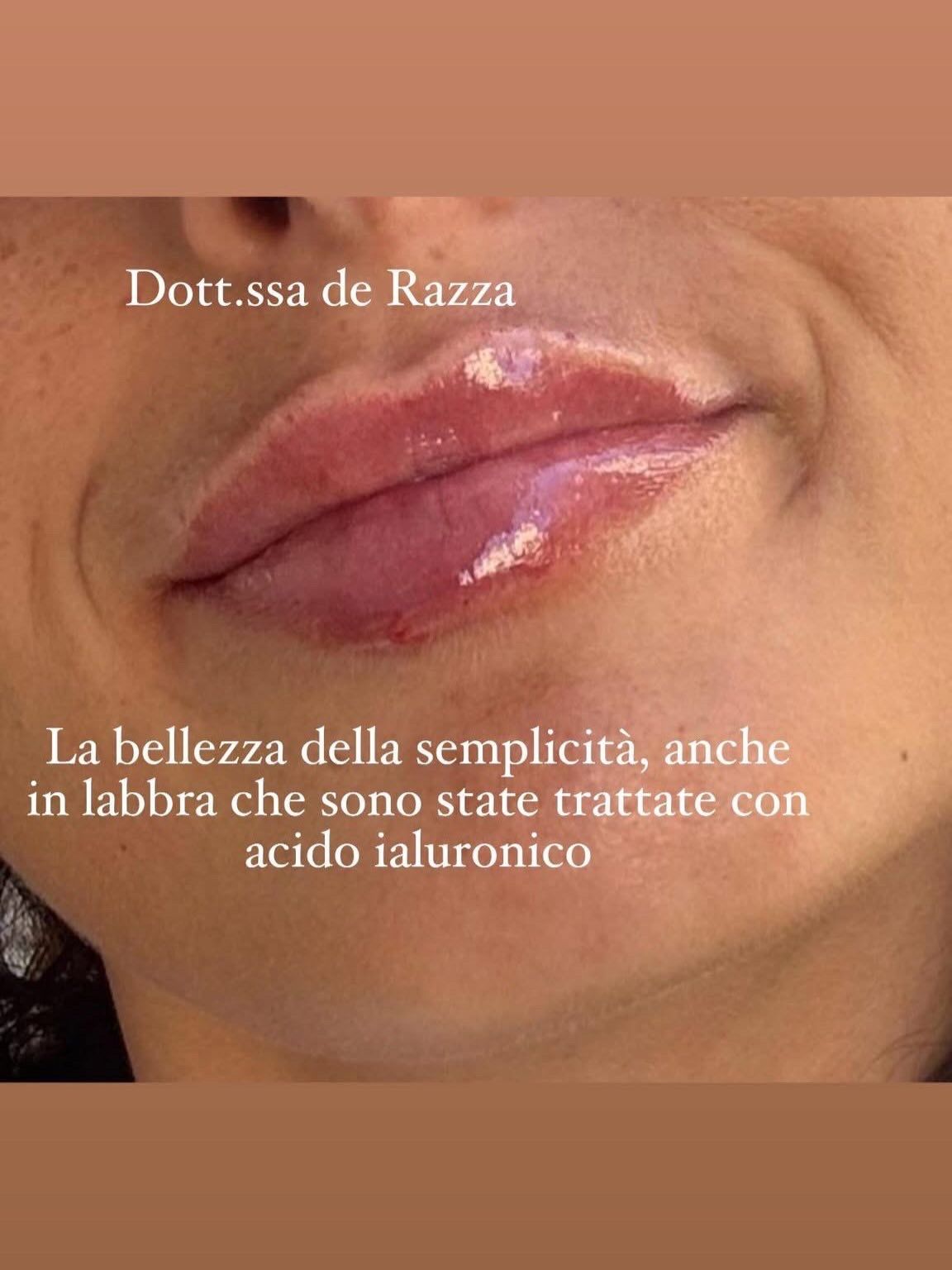Francesca De Razza-72