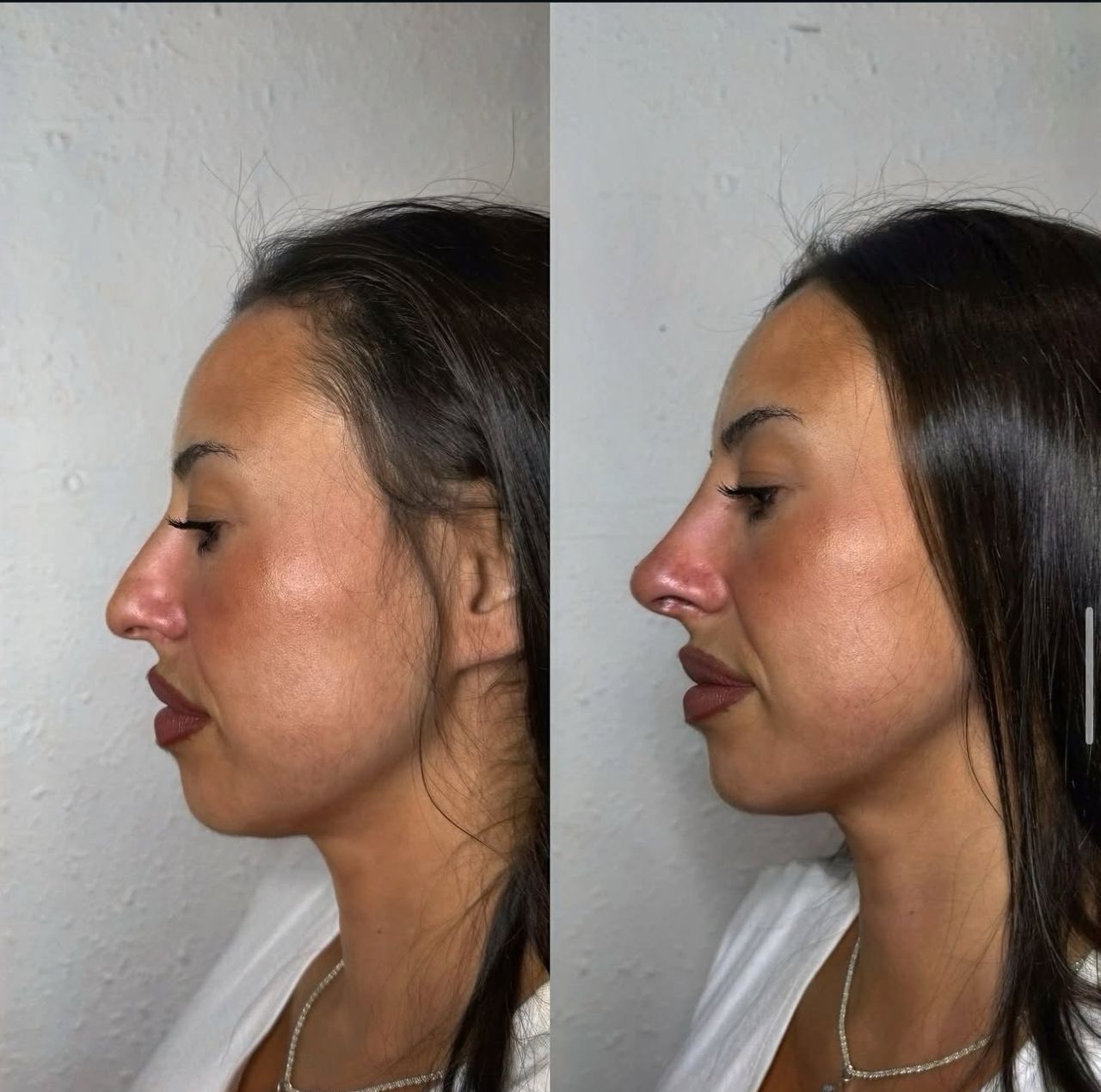 Andrea Catahysa Del Torto-7