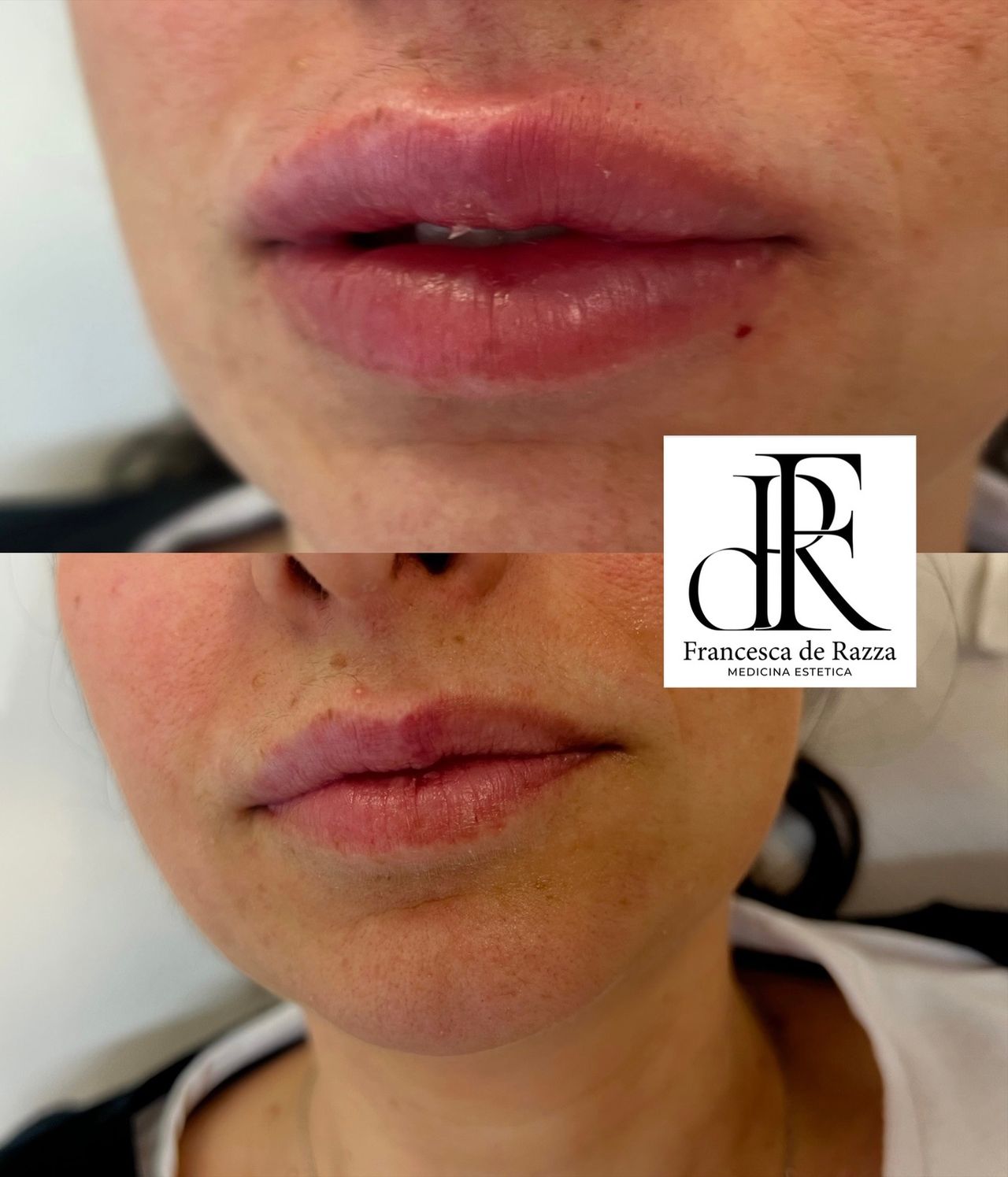 Francesca De Razza-71