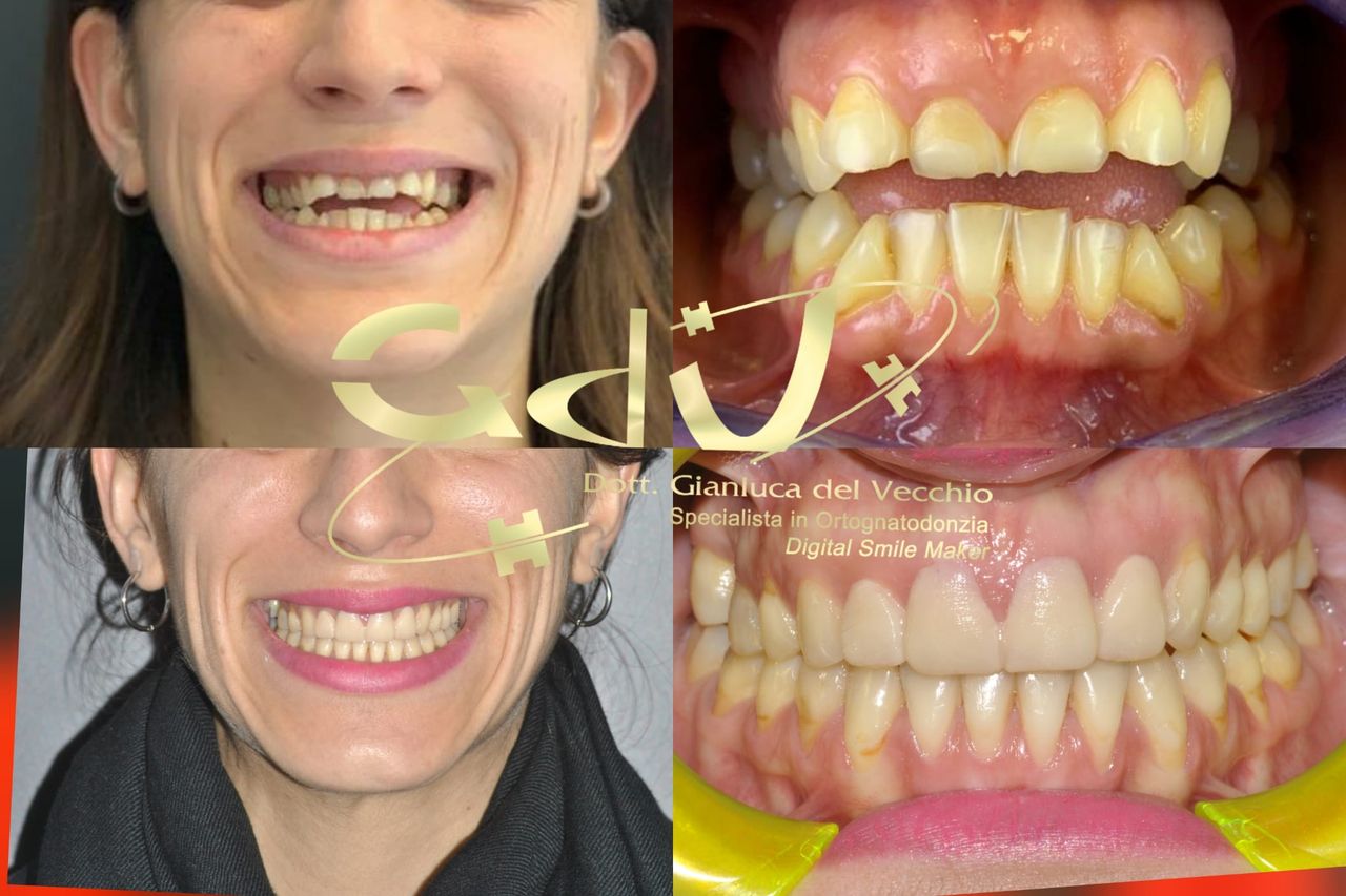 Gianluca Del Vecchio-174