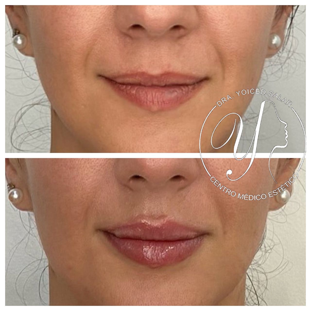 Yoiced Salar Peñate-14