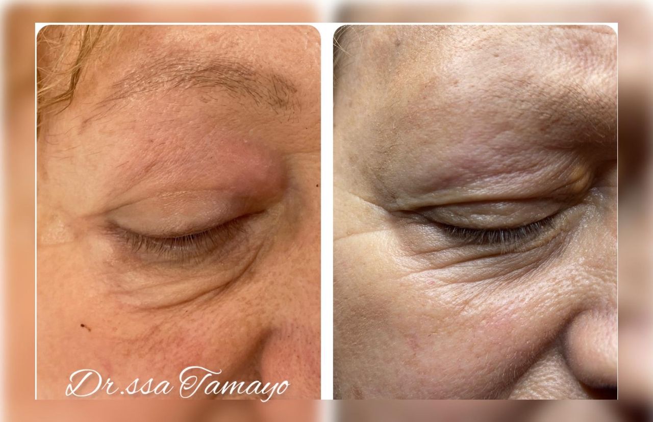 Lazara Dianelys Tamayo-4