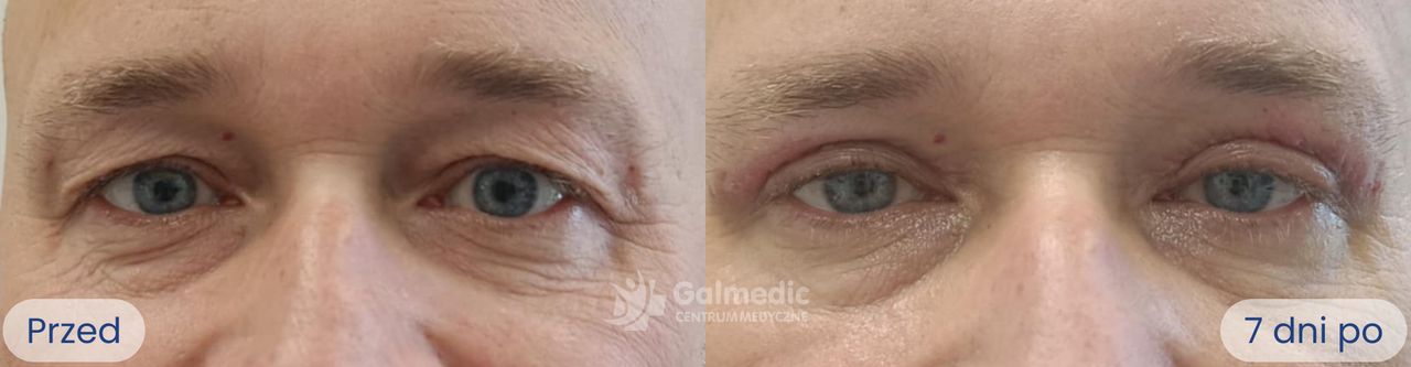 Aneta Michalik-Jakubek-3