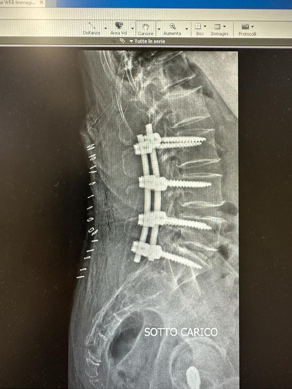 Valerio Cipolloni-32