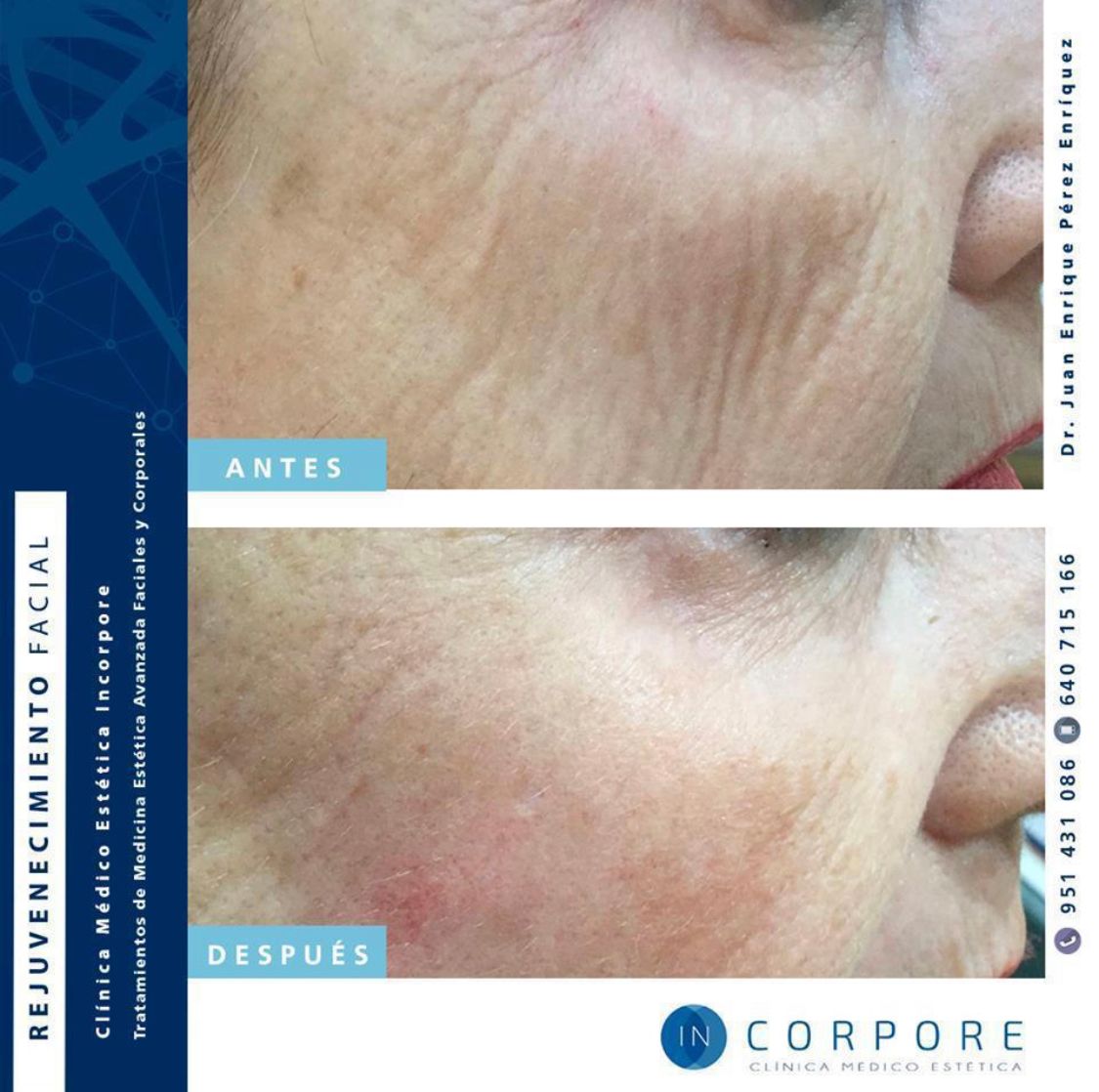 Juan Enrique Pérez Enríquez-42