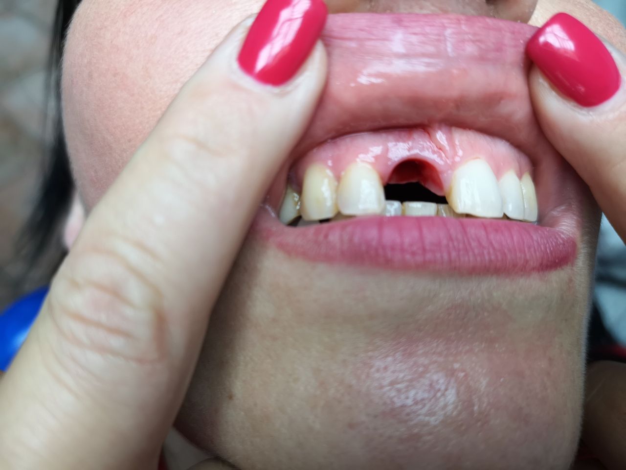 Stefano De Simone-52