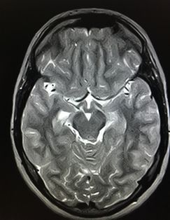 Cornelia Schröder-9