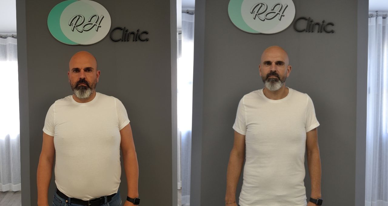 Rosalba Herrero Zerpa-169