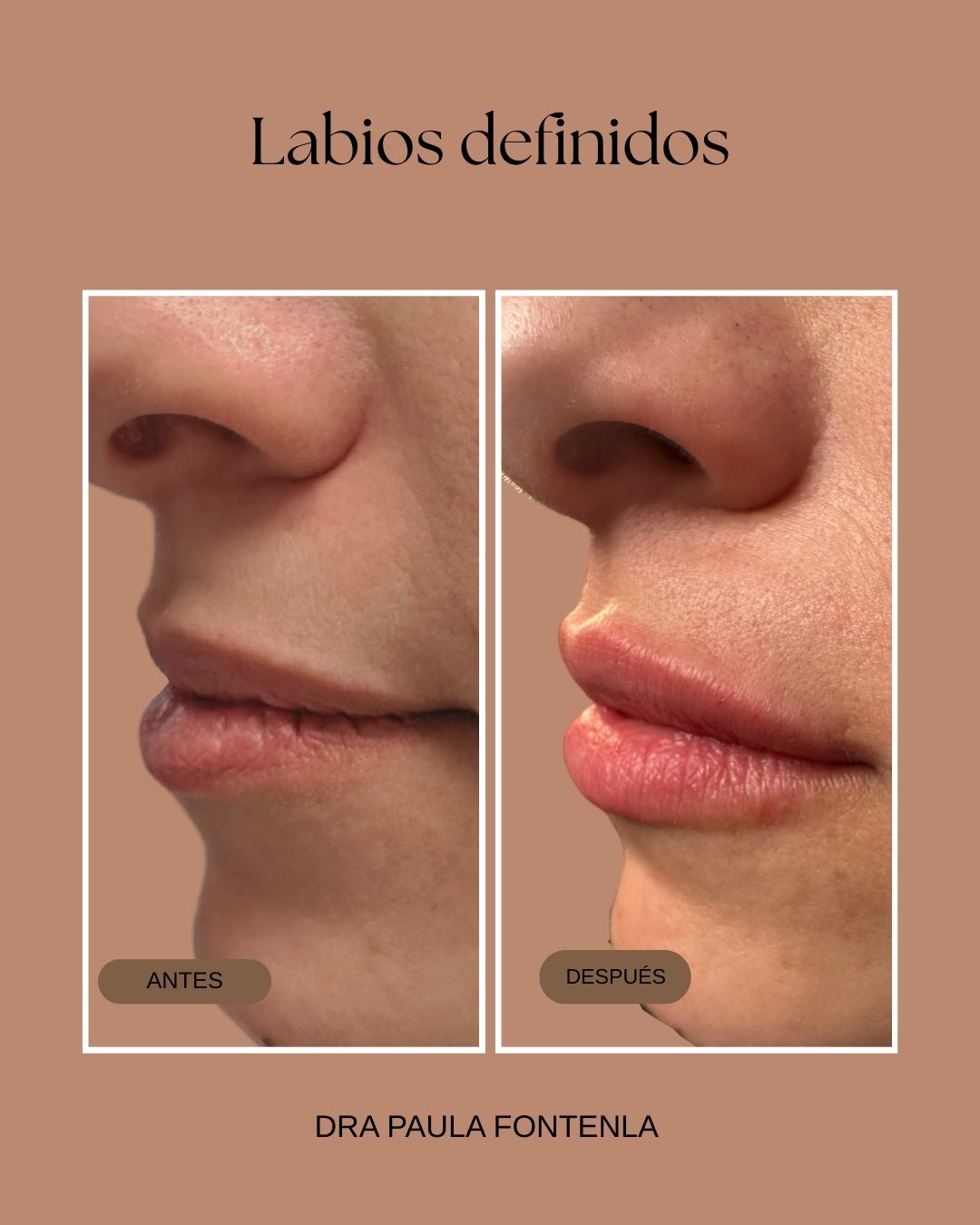 Paula Fontenla Seco-19