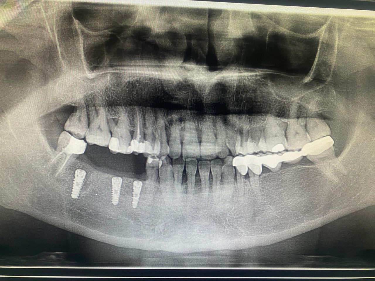 Luigi Giuseppe Romano-19