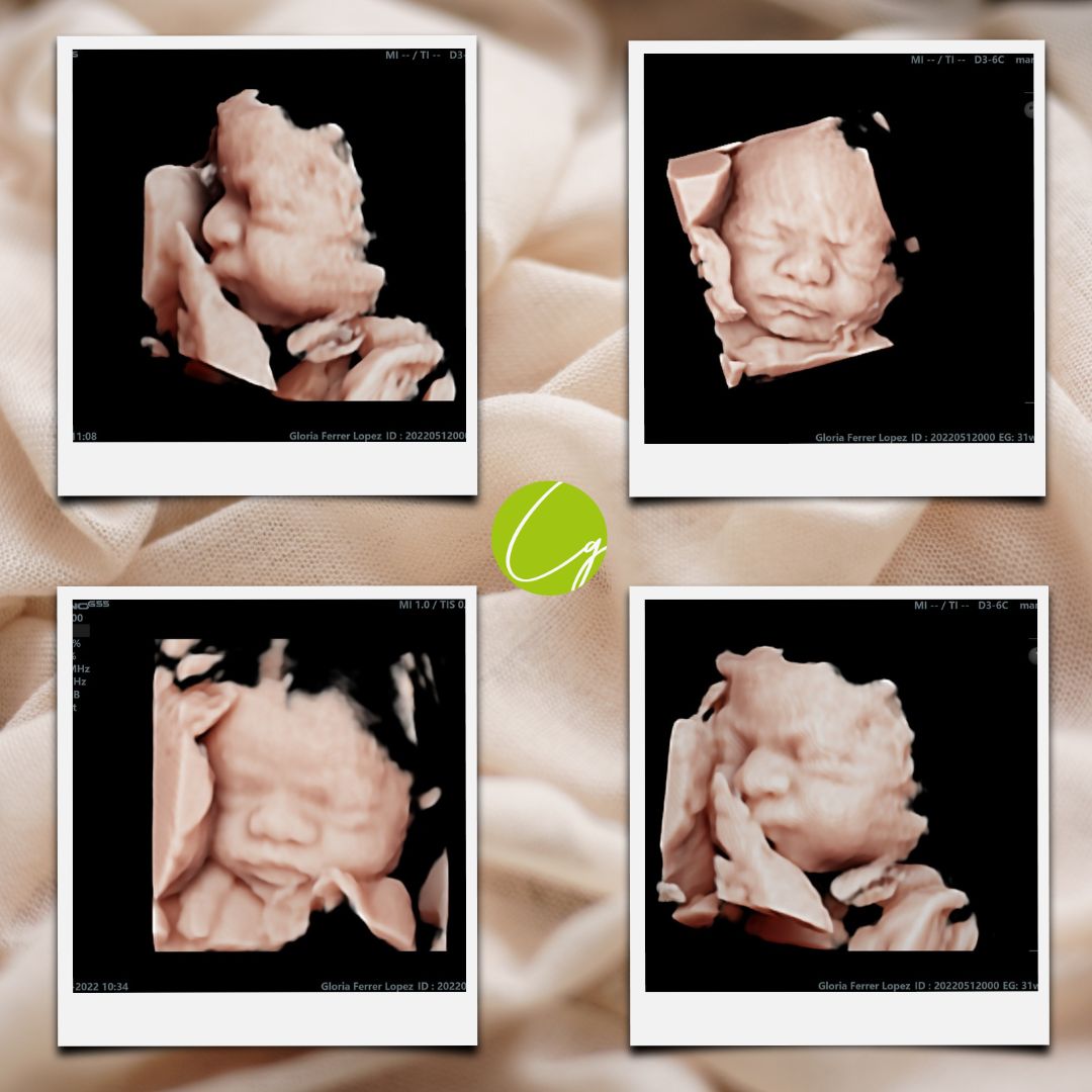 Raquel Gómez García-7