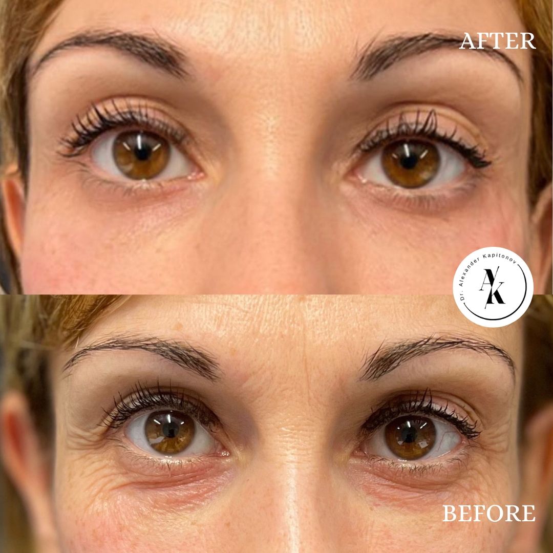 Alexandr Kapitonov-3