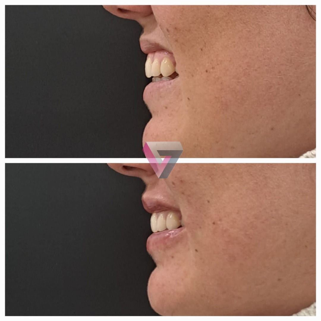 Victoria Trasmonte-91