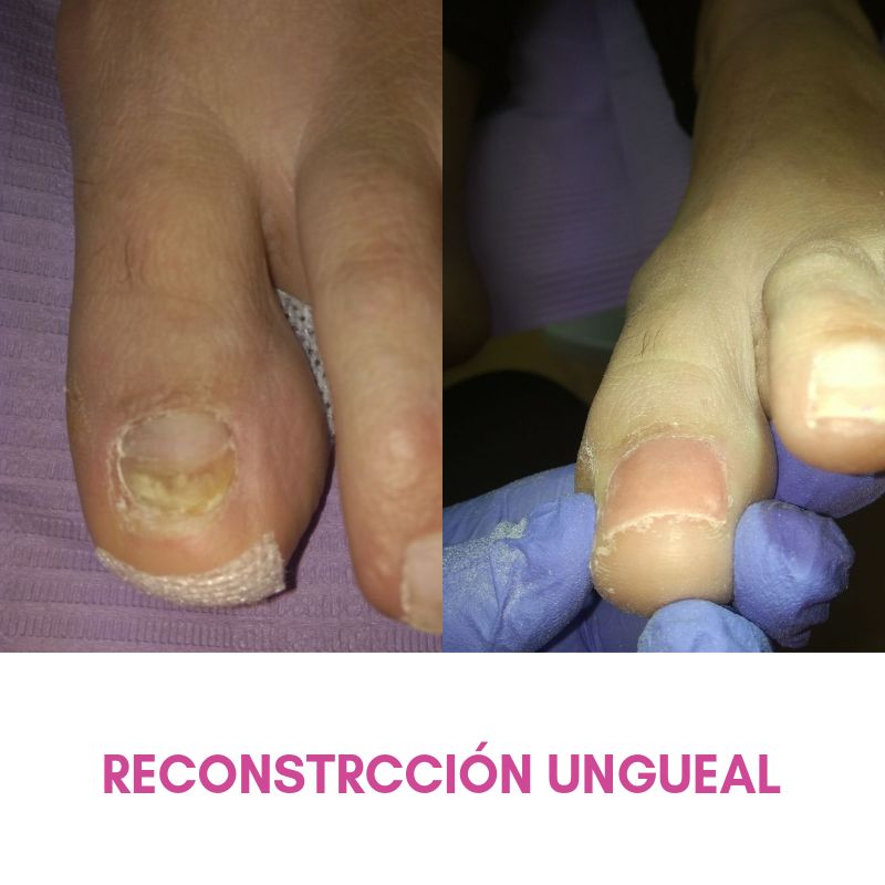 Salomé Antón Arnal-29