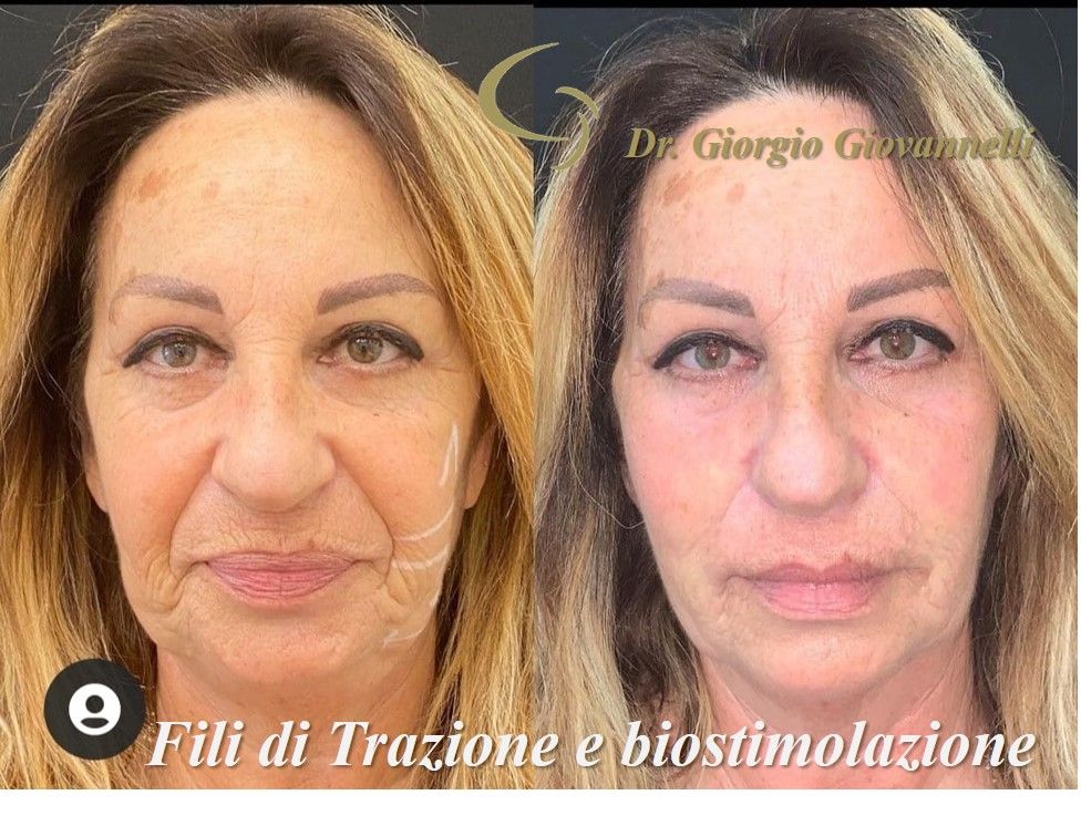 Giorgio Giovannelli-58