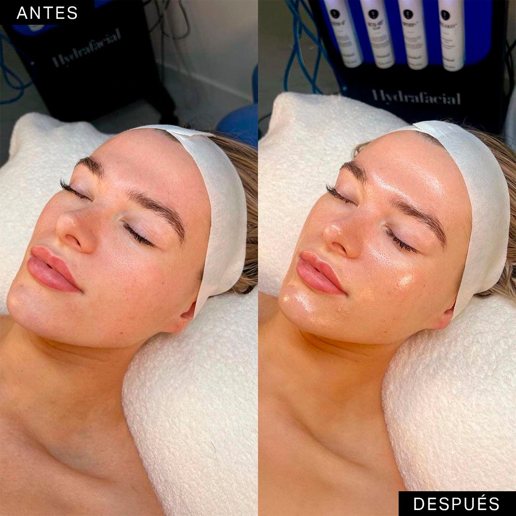 Alba Rubiño Estabén-0