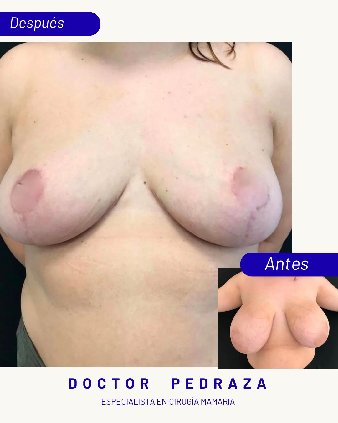 José María Pedraza Abad-3