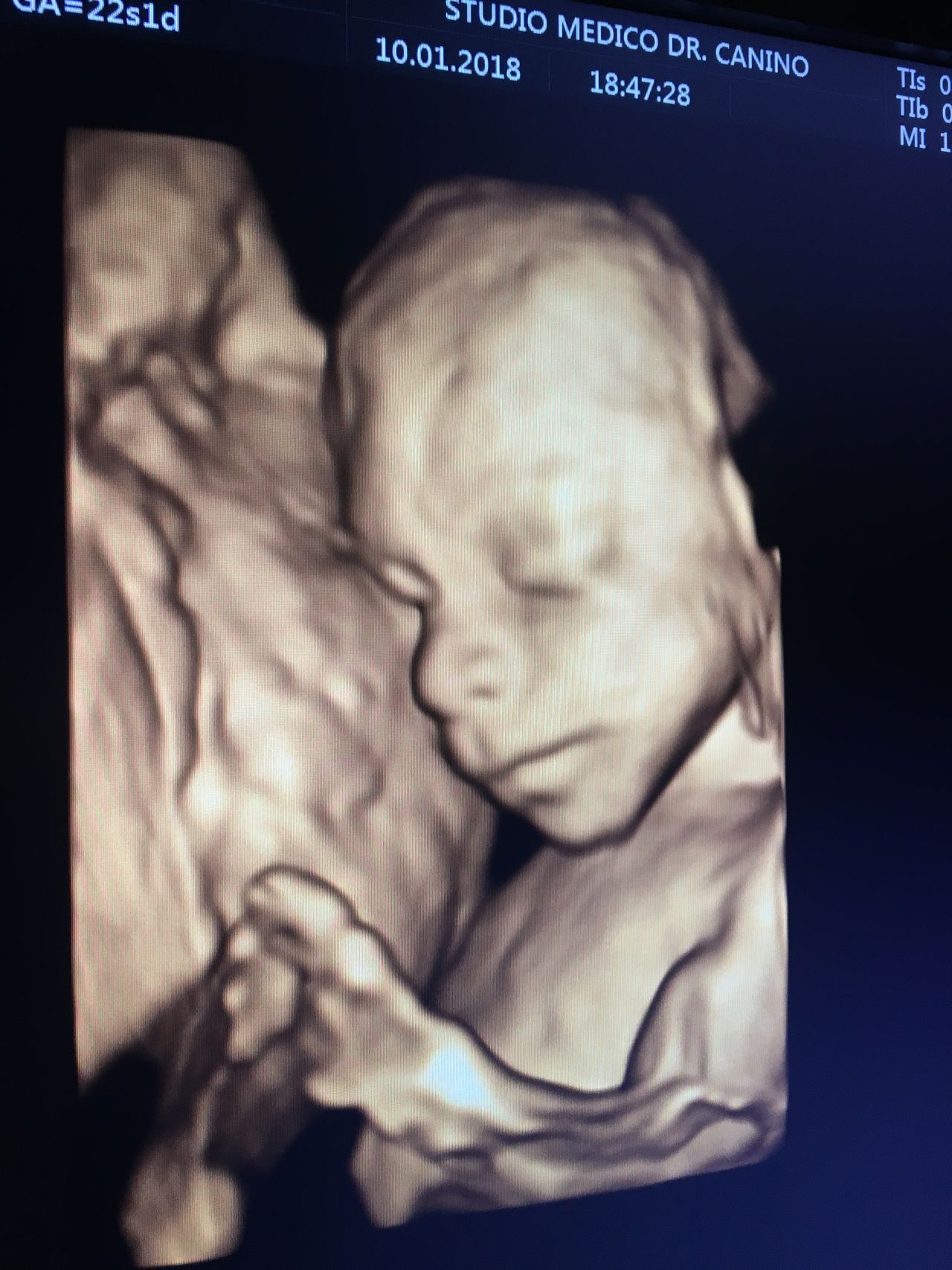 Francesco Antonio Bisogni-3