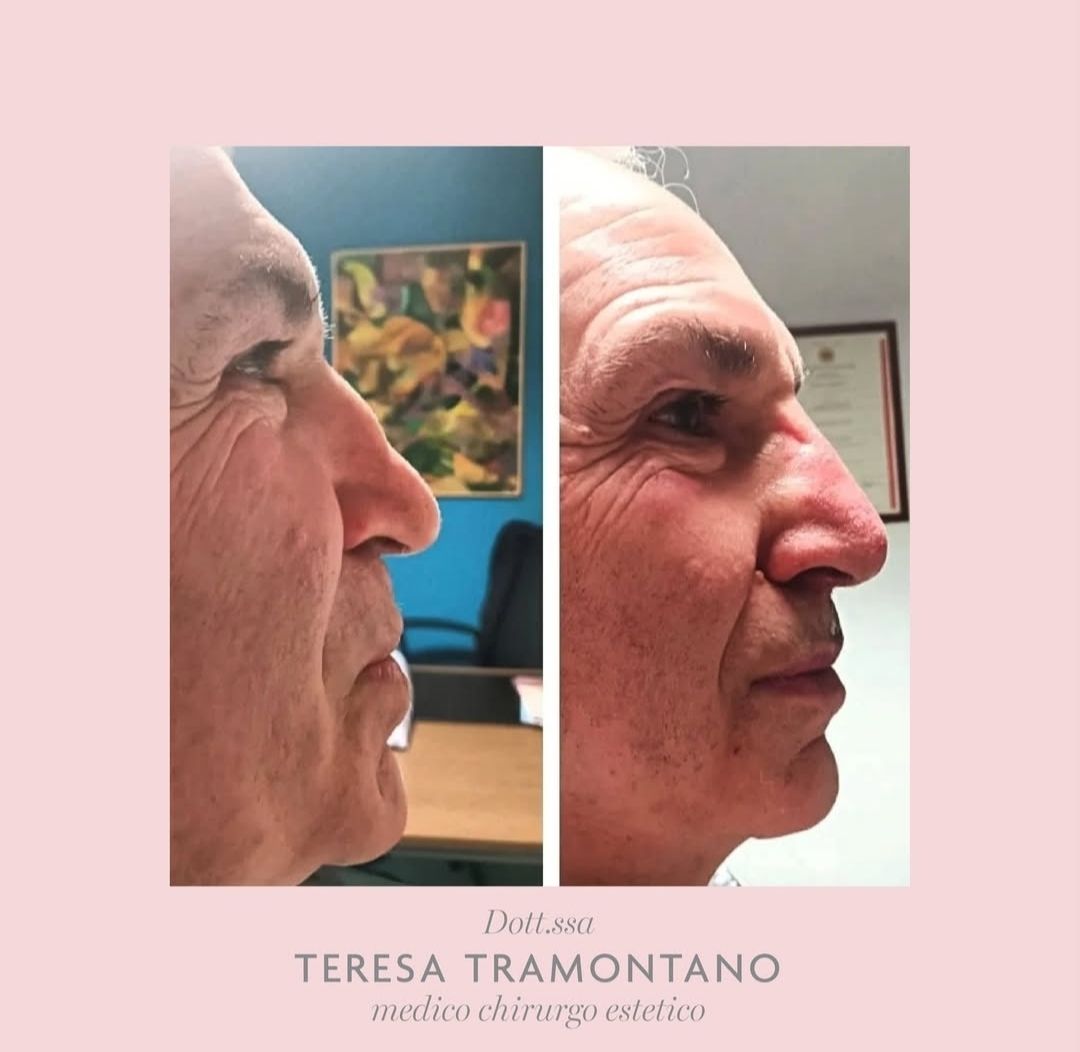 Teresa Tramontano-14