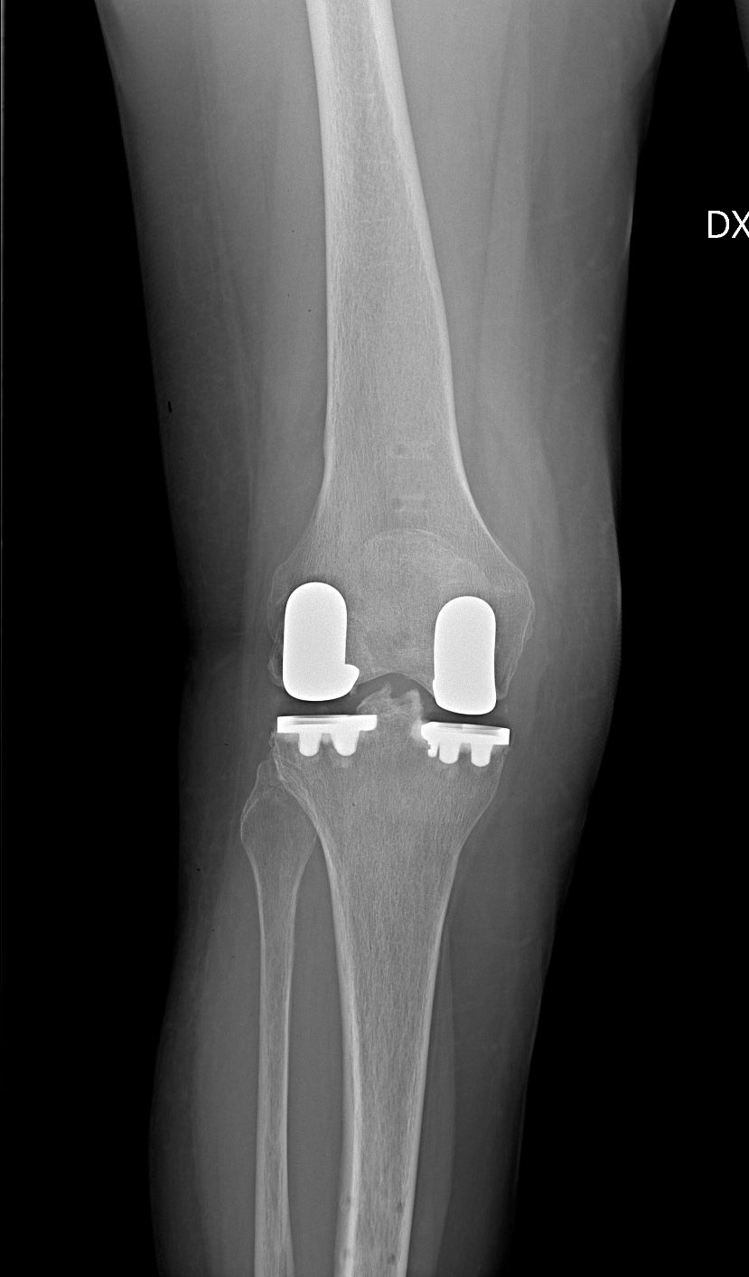 Antonello Della Rocca-16