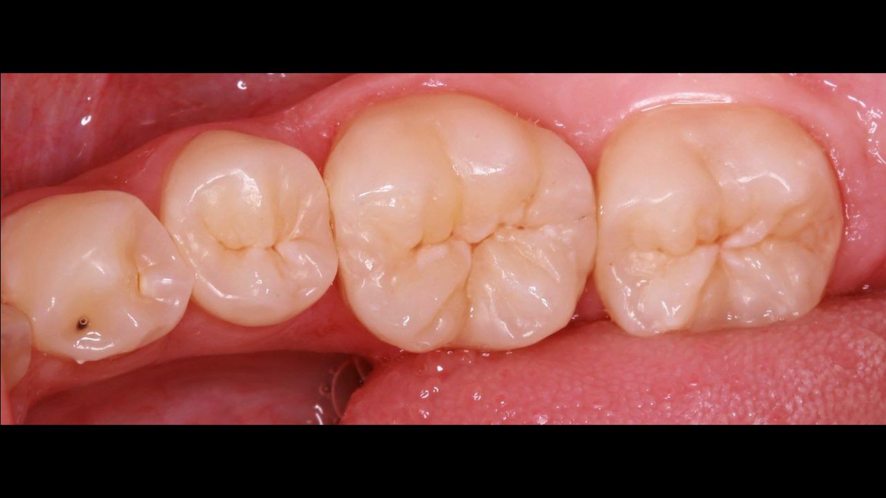 Volodymyr Kachmar-16